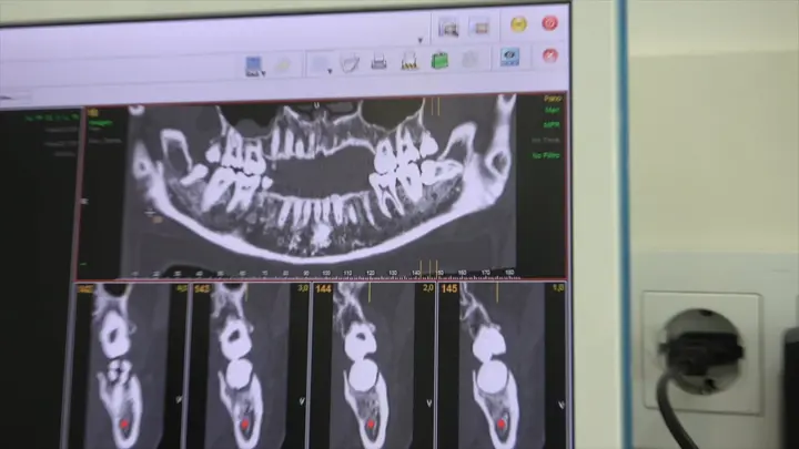 The third molar course — video still